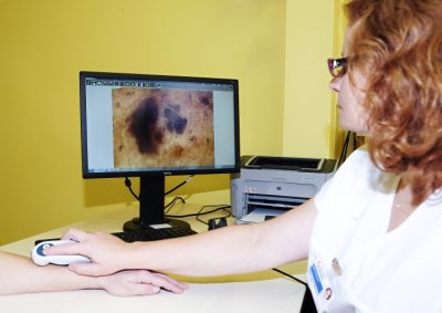 Nový dermatoskop pomůže odhalit problematická znaménka